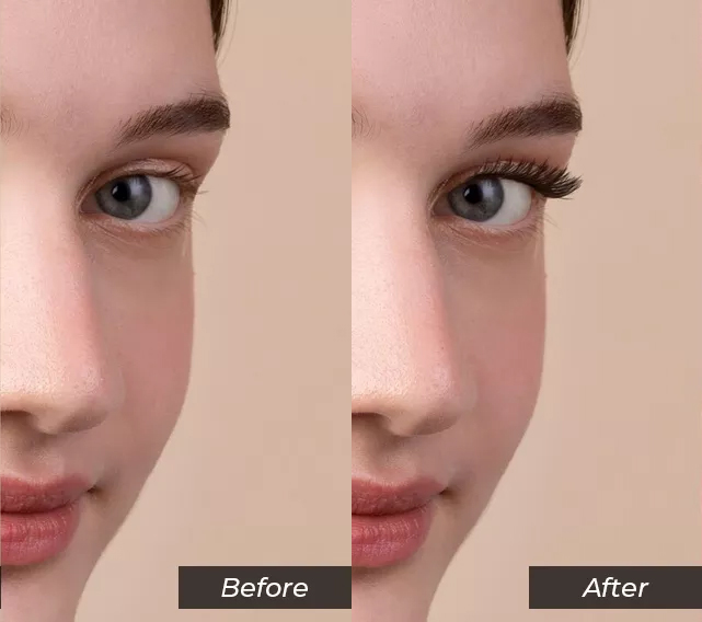 before-after